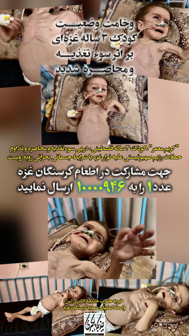 وخامت وضعیت کودک ۳ ساله _ 1404/6/15